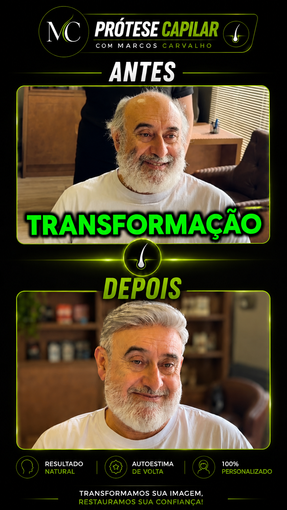 Transformação antes e depois com prótese capilar — resultado 5