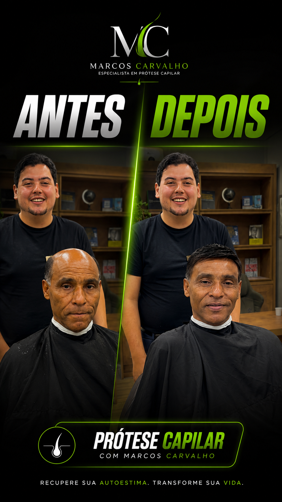 Transformação antes e depois com prótese capilar — resultado 7